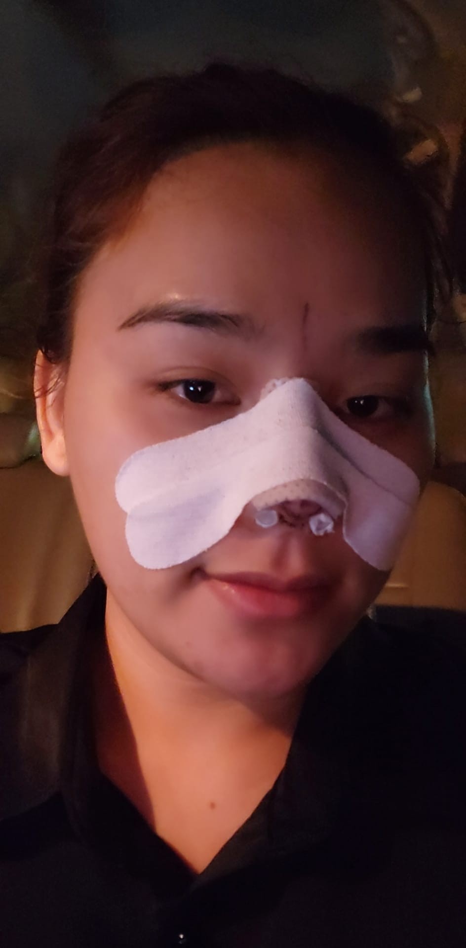 Thánh sún Ngân Thảo công khai trùng tu nhan sắc. Ảnh internet