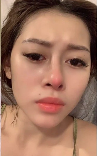 Chị Google từng công khai sửa mũi. Ảnh internet