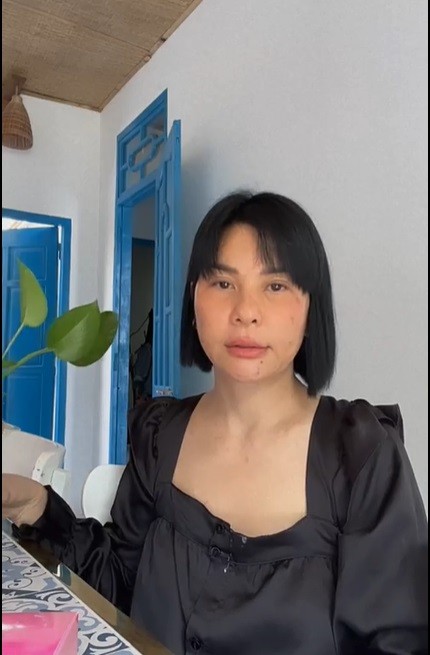Cát Phượng dính nghi vấn trùng tu nhan sắc sau khi chia tay Kiều Minh Tuấn. Ảnh internet Cát Phượng dính nghi vấn trùng tu nhan sắc sau khi chia tay Kiều Minh Tuấn. Ảnh internet