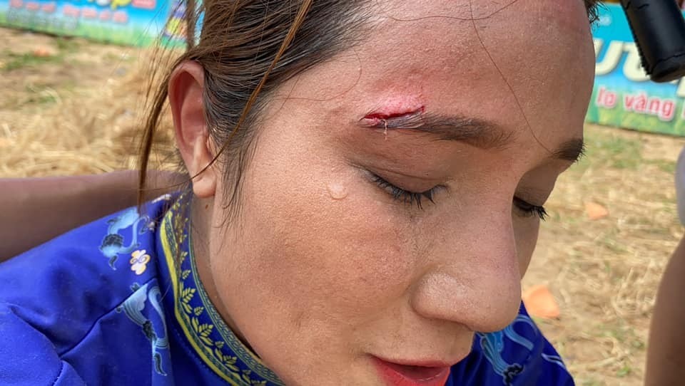 MC Cát Tường bị thương trong lúc ghi hình. Ảnh internet