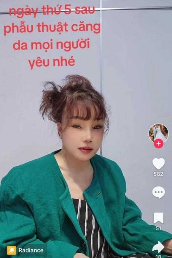 Cô dâu Thu Sao sử dụng photoshop để được trẻ hơn. Ảnh internet Cô dâu Thu Sao sử dụng photoshop để được trẻ hơn. Ảnh internet