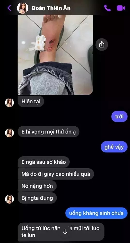 Hoa hậu Thiên Ân gặp thêm bất lợi về sức khỏe giữa thời điểm thi đấu quốc tế - Ảnh 1 Hoa hậu Thiên Ân gặp thêm bất lợi về sức khỏe giữa thời điểm thi đấu quốc tế - Ảnh 1