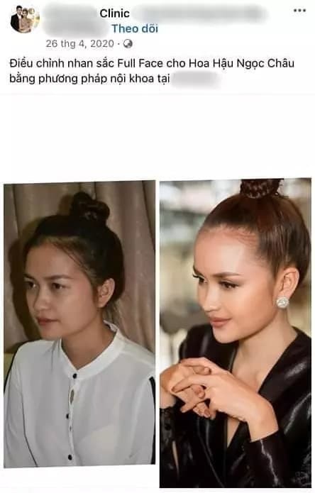 Sao Việt 13/2: HH Ngọc Châu gây xôn xao sau khi bị tố 'gian dối nhan sắc', Mâu Thủy hạ sinh con đầu lòng - Ảnh 1 Sao Việt 13/2: HH Ngọc Châu gây xôn xao sau khi bị tố 'gian dối nhan sắc', Mâu Thủy hạ sinh con đầu lòng - Ảnh 1