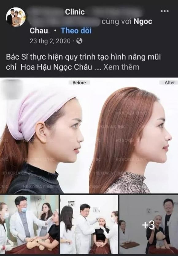 Ngọc Châu vô tình để lộ vóc dáng kém nuột nà giữa nghi vấn phẫu thuật thẩm mỹ - Ảnh 1