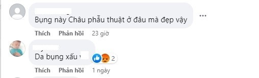 Ngọc Châu vô tình để lộ vóc dáng kém nuột nà giữa nghi vấn phẫu thuật thẩm mỹ - Ảnh 4