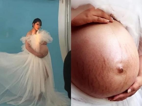 Đặng Thu Thảo từng có một thời xuống sắc. Ảnh: FBNV Đặng Thu Thảo từng có một thời xuống sắc. Ảnh: FBNV