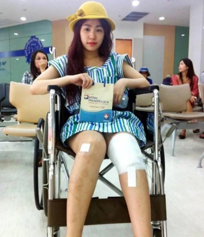 Lương Bích Hữu kể về giai đoạn đen tối nhất cuộc đời sau khi vướng tai nạn lúc di diễn 2 Lương Bích Hữu kể về giai đoạn đen tối nhất cuộc đời sau khi vướng tai nạn lúc di diễn 2
