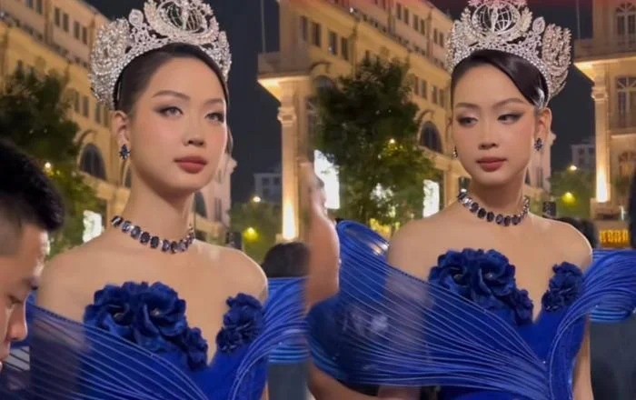 Bảo Ngọc lộ rõ đôi mắt lờ đời, thiếu sức sống. Ảnh: Internet Bảo Ngọc lộ rõ đôi mắt lờ đời, thiếu sức sống. Ảnh: Internet