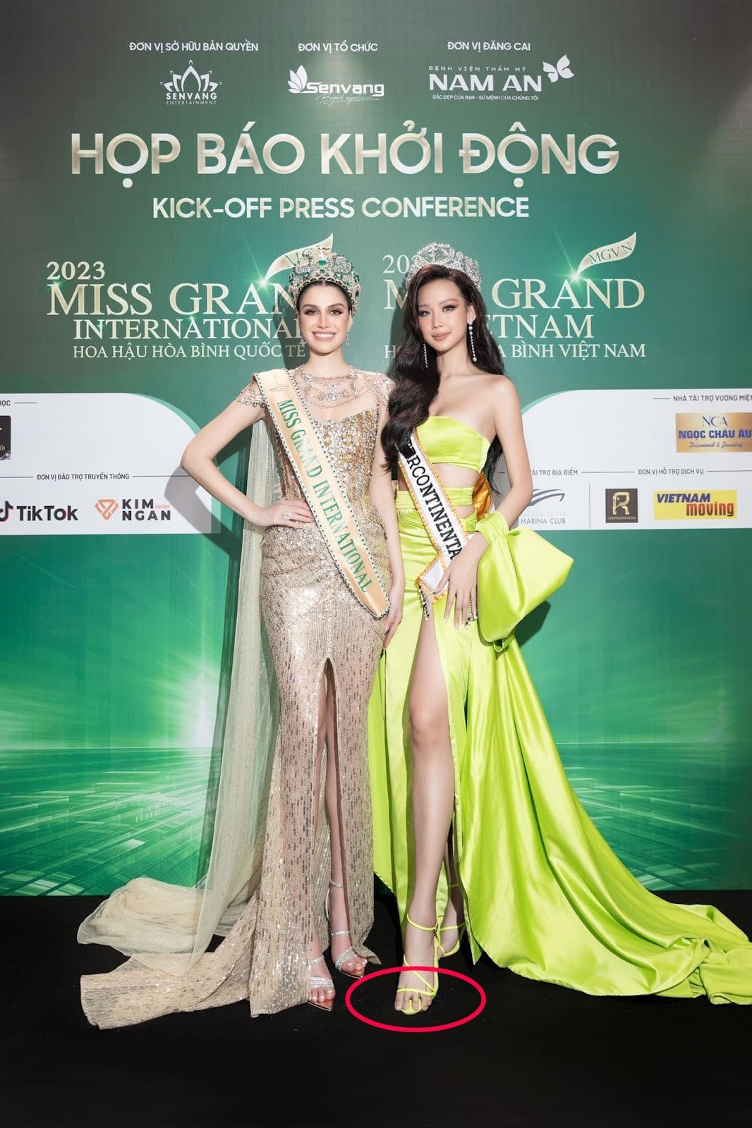 Chi tiết khiến hình ảnh của Bảo Ngọc trở nên chưa được hoàn hảo. Ảnh: Internet