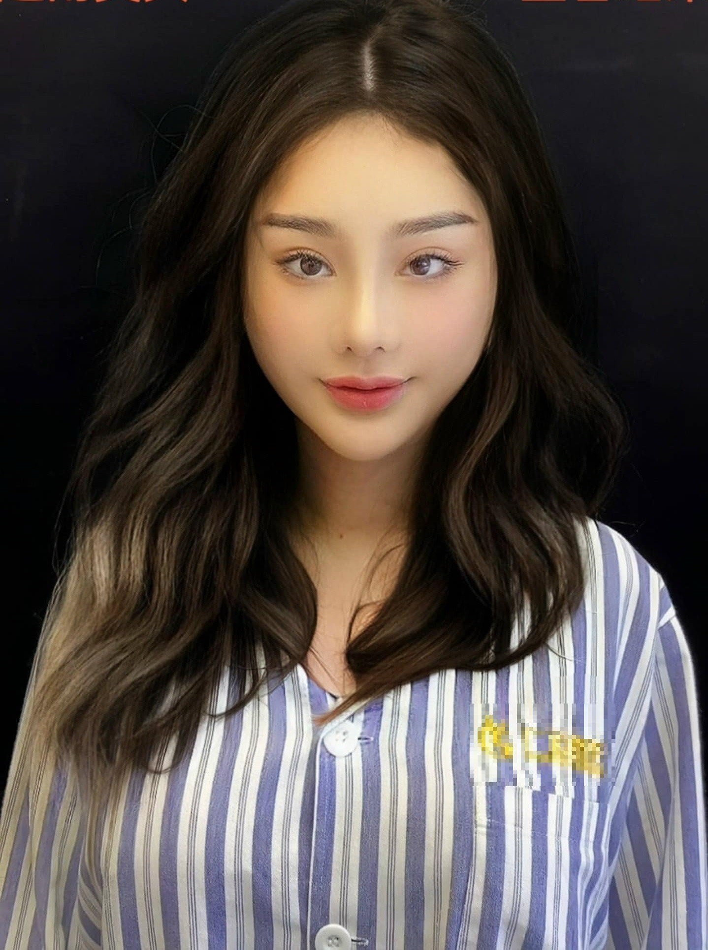 Hình ảnh hậu phẫu do chính Lâm Khánh Chi đăng tải. Ảnh: FBNV