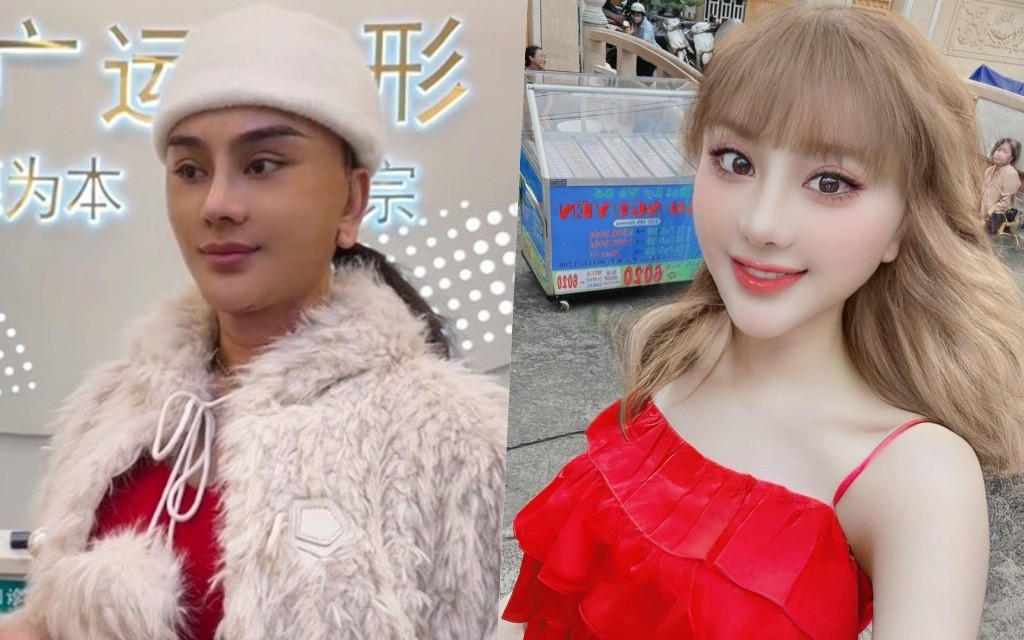 Lâm Khánh Chi không ngại chi tiền thực hiện thẩm mỹ. Ảnh: FBNV