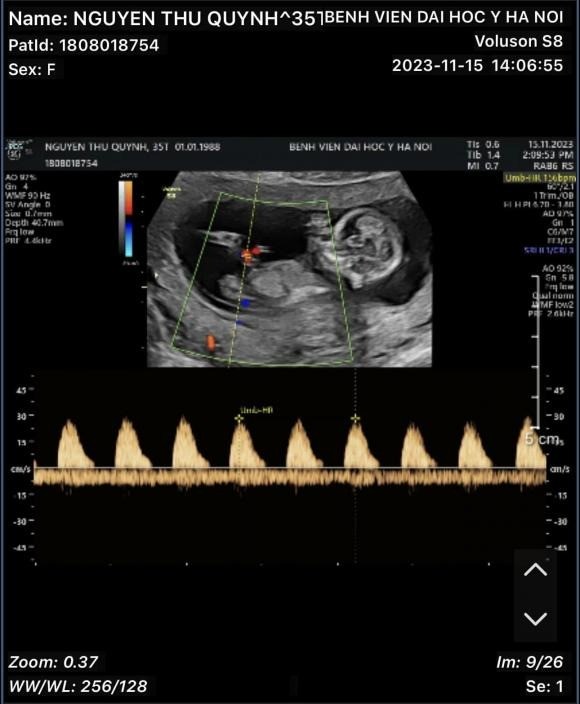Thu Quỳnh cách đây ít ngày báo tin vui khi mang bầu lần 2. Ảnh: FBNV Thu Quỳnh cách đây ít ngày báo tin vui khi mang bầu lần 2. Ảnh: FBNV