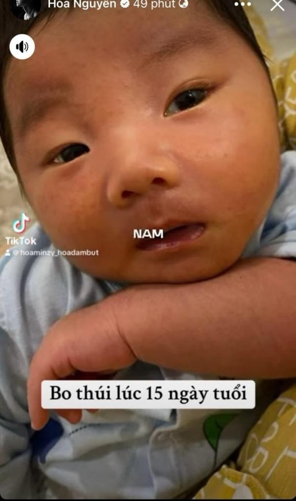 Ảnh bé Bo khi mới 15 ngày tuổi. Ảnh: Internet Ảnh bé Bo khi mới 15 ngày tuổi. Ảnh: Internet