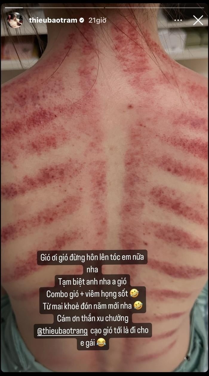 Sao Việt 30/12: Thiều Bảo Trâm để lộ tình trạng đáng lo ngại, Lý Nhã Kỳ chốt ngày lấy chồng - Ảnh 2 Sao Việt 30/12: Thiều Bảo Trâm để lộ tình trạng đáng lo ngại, Lý Nhã Kỳ chốt ngày lấy chồng - Ảnh 2