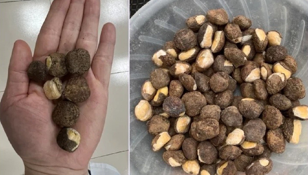 Lạng Sơn: Ăn loại hạt có hình dáng giống hạt dẻ, gần 20 người nhập viện 1 Lạng Sơn: Ăn loại hạt có hình dáng giống hạt dẻ, gần 20 người nhập viện 1