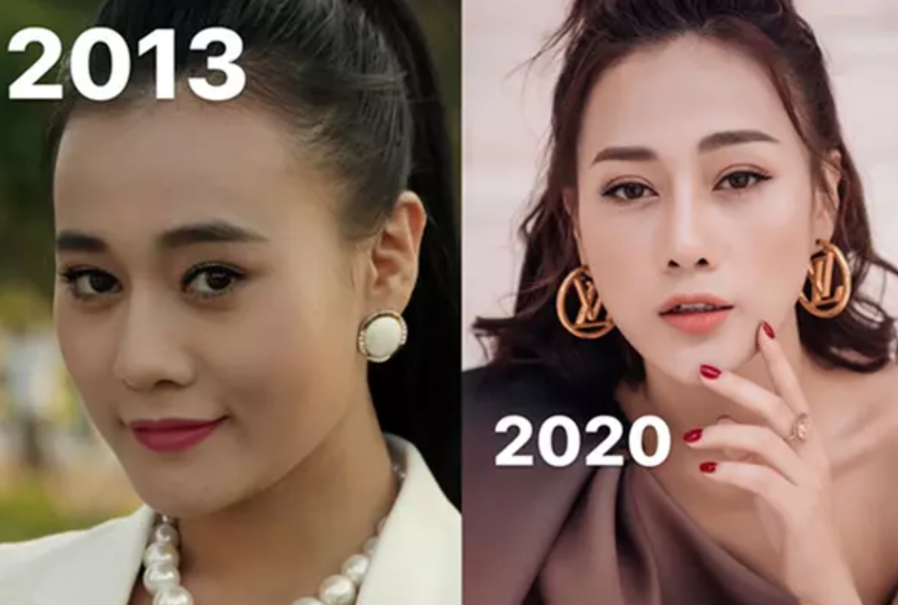 Clip Phương Oanh thời chưa phẫu thuật thẩm mỹ hot trở lại, nhan sắc khiến khán giả cứ tiếc mãi - Ảnh 1
