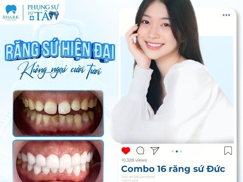 Nha Khoa Shark - Địa chỉ bọc răng sứ uy tín tại TPHCM Nha Khoa Shark - Địa chỉ bọc răng sứ uy tín tại TPHCM