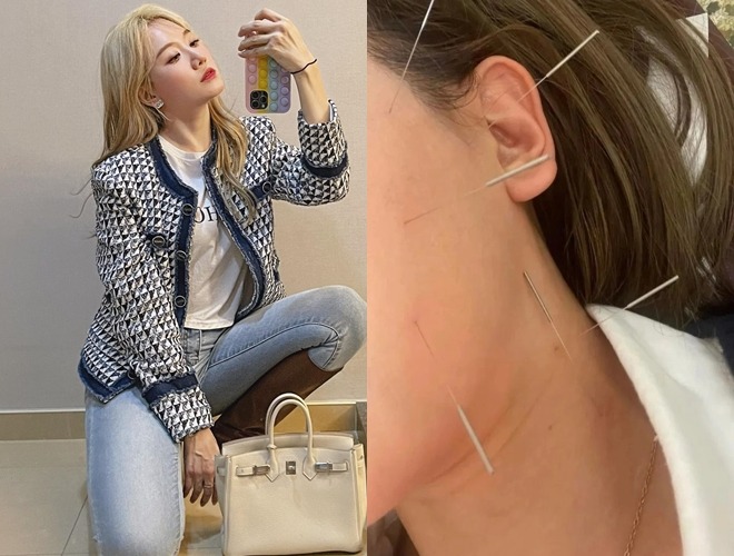 Hari Won thời gian qua sang Hàn Quốc để điều trị bệnh (Ảnh: Internet)