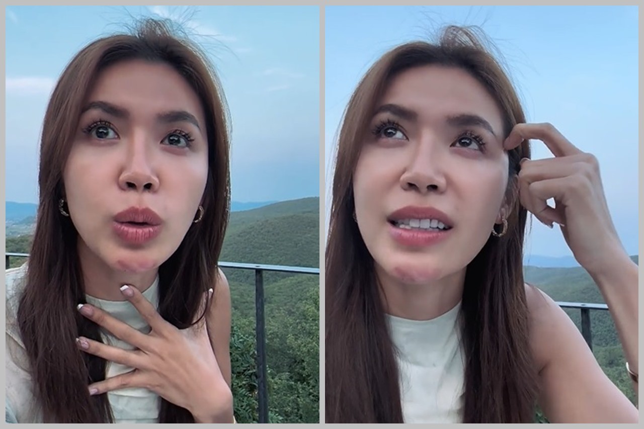 Minh Tú chia sẻ về vết thương hiện tại. Ảnh chụp màn hình. Minh Tú chia sẻ về vết thương hiện tại. Ảnh chụp màn hình.