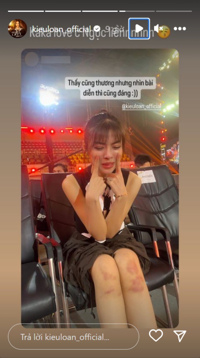 Vết thương của Á hậu Kiều Loan khiến nhiều người lo lắng. Ảnh FB Lona Kiều Loan