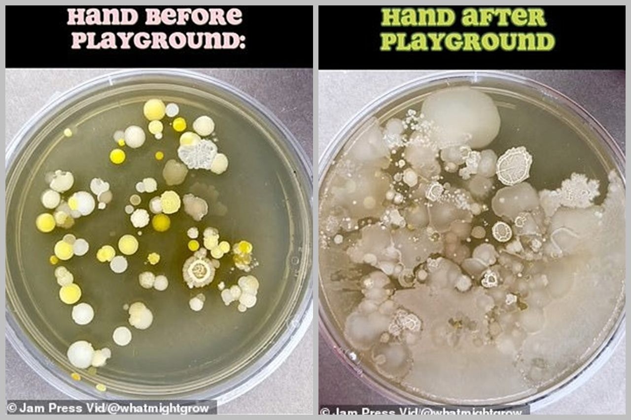 Tim có phát hiện kỳ ​​lạ khi so sánh lượng vi khuẩn trên tay trẻ trước và sau một giờ ở sân chơi công viên.