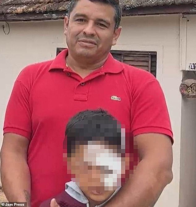 Paulo Rocha cùng con trai Raphael dos Santos, người rơi xuống hố ga ở Brazil hôm thứ Hai. Cậu bé 7 tuổi phải khâu 25 mũi trên lông mày. Paulo Rocha cùng con trai Raphael dos Santos, người rơi xuống hố ga ở Brazil hôm thứ Hai. Cậu bé 7 tuổi phải khâu 25 mũi trên lông mày.