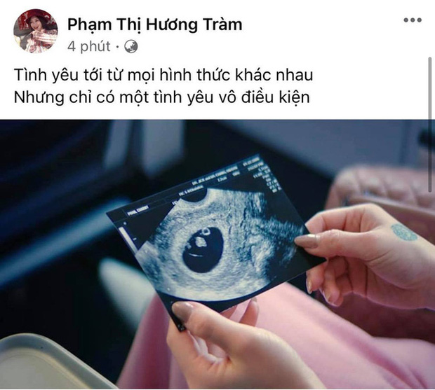Hình ảnh gây xôn xao của Hương Tràm. Ảnh chụp màn hình Hình ảnh gây xôn xao của Hương Tràm. Ảnh chụp màn hình