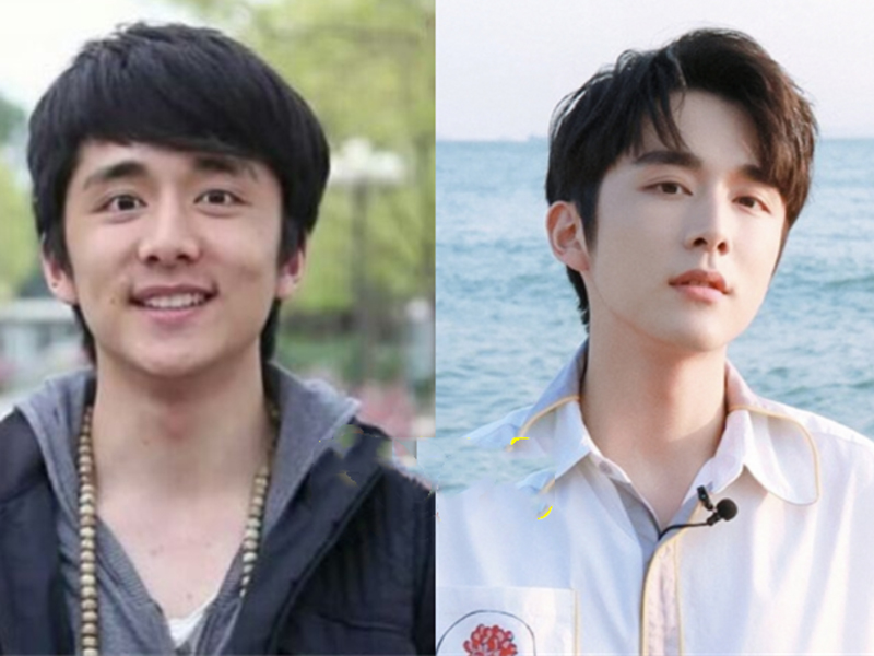 Nhắc đến dàn nam thần thay đổi chóng mặt khi giảm cân thì không thể thiếu Trương Tân Thành. Tuy nhiên, so với bức hình trong quá khứ có phần hơi thừa cân thì rõ ràng bức ảnh hiện tại của Trương Tân Thành khiến vạn người mê dù không thay đổi quá nhiều.