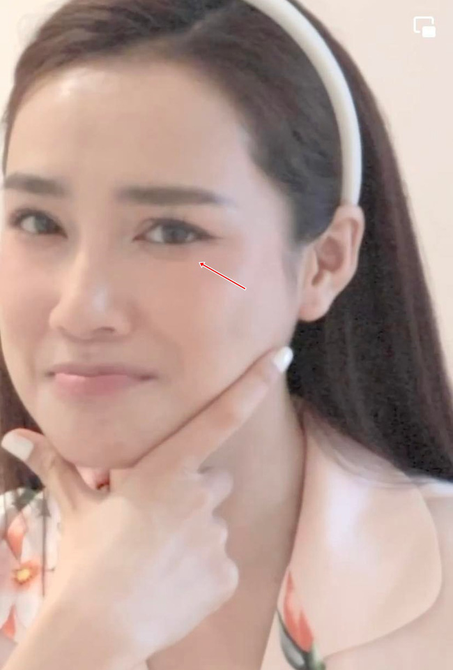 Nhã Phương thừa nhận khuyết điểm trên gương mặt ở tuổi 32. Nhã Phương thừa nhận khuyết điểm trên gương mặt ở tuổi 32.