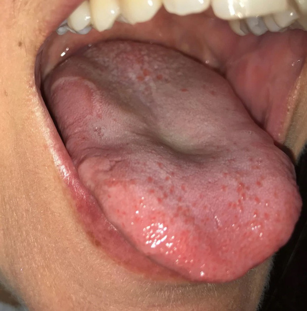 Các chuyên gia cảnh báo không nên coi thường các triệu chứng này. Ảnh: The Sun