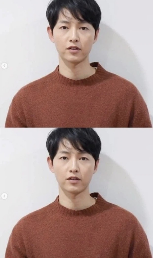 Trước đó Song Joong Ki bị săm soi gương mặt sập xệ. Ảnh: Internet Trước đó Song Joong Ki bị săm soi gương mặt sập xệ. Ảnh: Internet