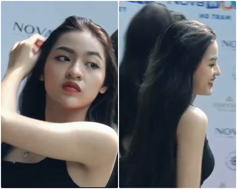 Hình ảnh góc nghiêng với hai diện mạo hoàn toàn khác lạ của tiktoker 'trứng rán cần mỡ' đang gây tranh cãi mới đây. Ảnh: Tiktok