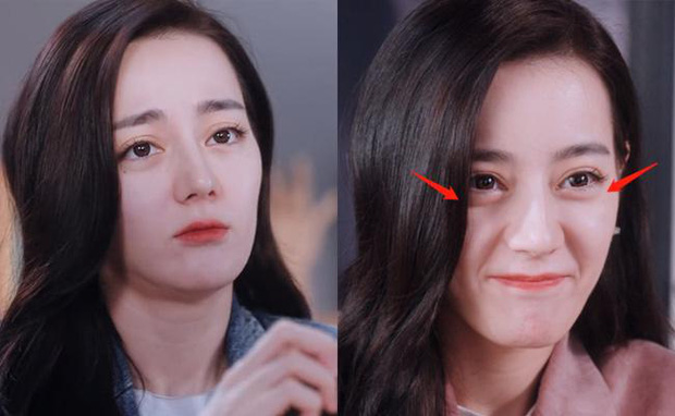 Địch Lệ Nhiệt Ba thường xuyên bị soi làn da chảy xệ lão hóa. Ảnh: Internet Địch Lệ Nhiệt Ba thường xuyên bị soi làn da chảy xệ lão hóa. Ảnh: Internet