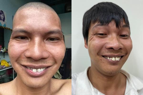 Hiện tượng mạng Lộc Fuho khiến dân tình ngỡ ngàng với diện mạo khác lạ, nghi đụng dao kéo - Ảnh 1 Hiện tượng mạng Lộc Fuho khiến dân tình ngỡ ngàng với diện mạo khác lạ, nghi đụng dao kéo - Ảnh 1