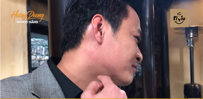 Vết hằn trên má Hồng Đăng. Vết hằn trên má Hồng Đăng.