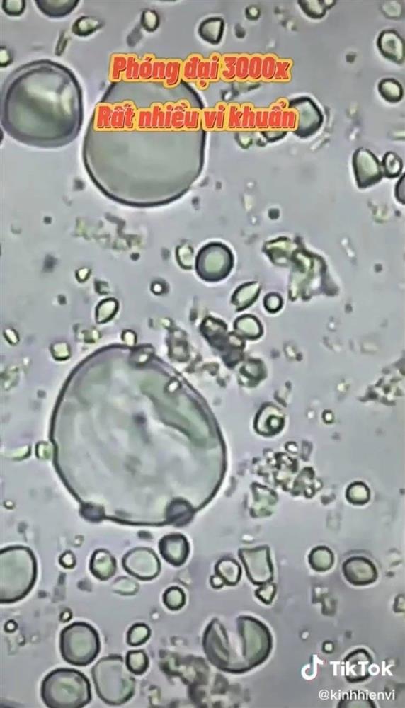 Hình ảnh bò khô siêu rẻ được soi dưới kính hiển vi khiến nhiều người không thể tin vào mắt mình - Ảnh 1