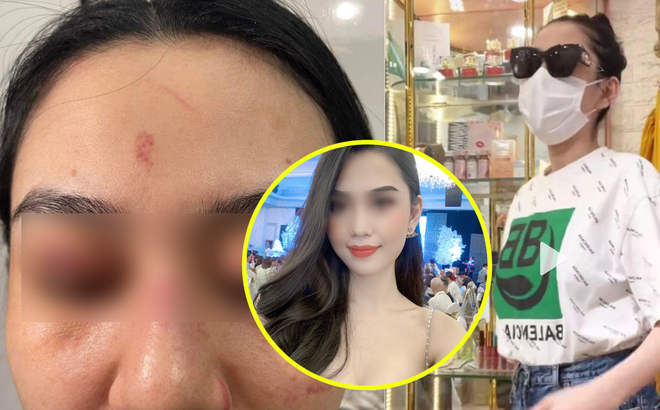 Được biết, chị Lê Khanh vừa sinh em bé được 4-5 tháng, hiện cô đang đợi kết quả giám định thương tật của bệnh viện. Được biết, chị Lê Khanh vừa sinh em bé được 4-5 tháng, hiện cô đang đợi kết quả giám định thương tật của bệnh viện.