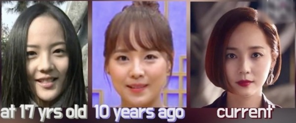 Gương mặt của Eugene trong Penthouse được xem là báu vật. Kết luận này được một bác sĩ thẩm mỹ chia sẻ. Không hổ danh mỹ nhân SM được mệnh danh là 'chị đẹp'.