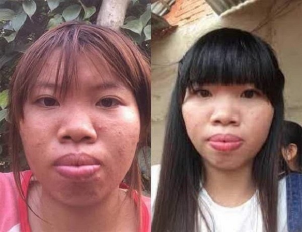 Quách Phượng từng bị coi là 'Thị Nở' vì sở hữu gương mặt xấu xí (ảnh internet) Quách Phượng từng bị coi là 'Thị Nở' vì sở hữu gương mặt xấu xí (ảnh internet)