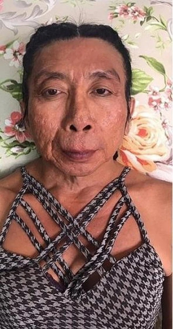 Gương mặt rỗ từng làm nên thương hiệu của người phụ nữ chuyển giới này Gương mặt rỗ từng làm nên thương hiệu của người phụ nữ chuyển giới này