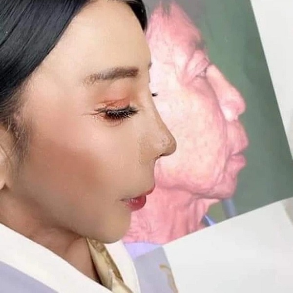 Không nhận ra gương mặt của người phụ nữ này hậu thẩm mỹ Không nhận ra gương mặt của người phụ nữ này hậu thẩm mỹ