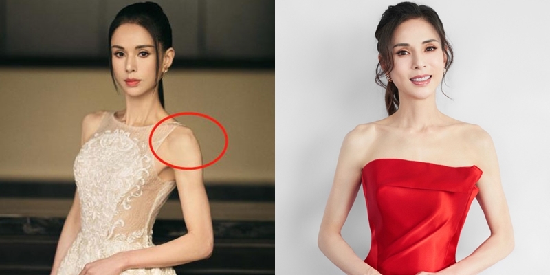 'Tiểu Long Nữ' Lý Nhược Đồng lộ diện mạo gầy trơ xương. Ảnh: Internet 'Tiểu Long Nữ' Lý Nhược Đồng lộ diện mạo gầy trơ xương. Ảnh: Internet