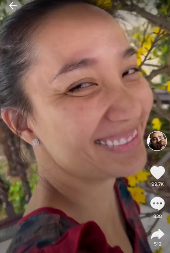 Bà xã Lê Dương Bảo Lâm lộ khuyết điểm nhan sắc