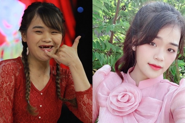Ngân Thảo ngày ấy - bây giờ. Ảnh: FBNV Ngân Thảo ngày ấy - bây giờ. Ảnh: FBNV