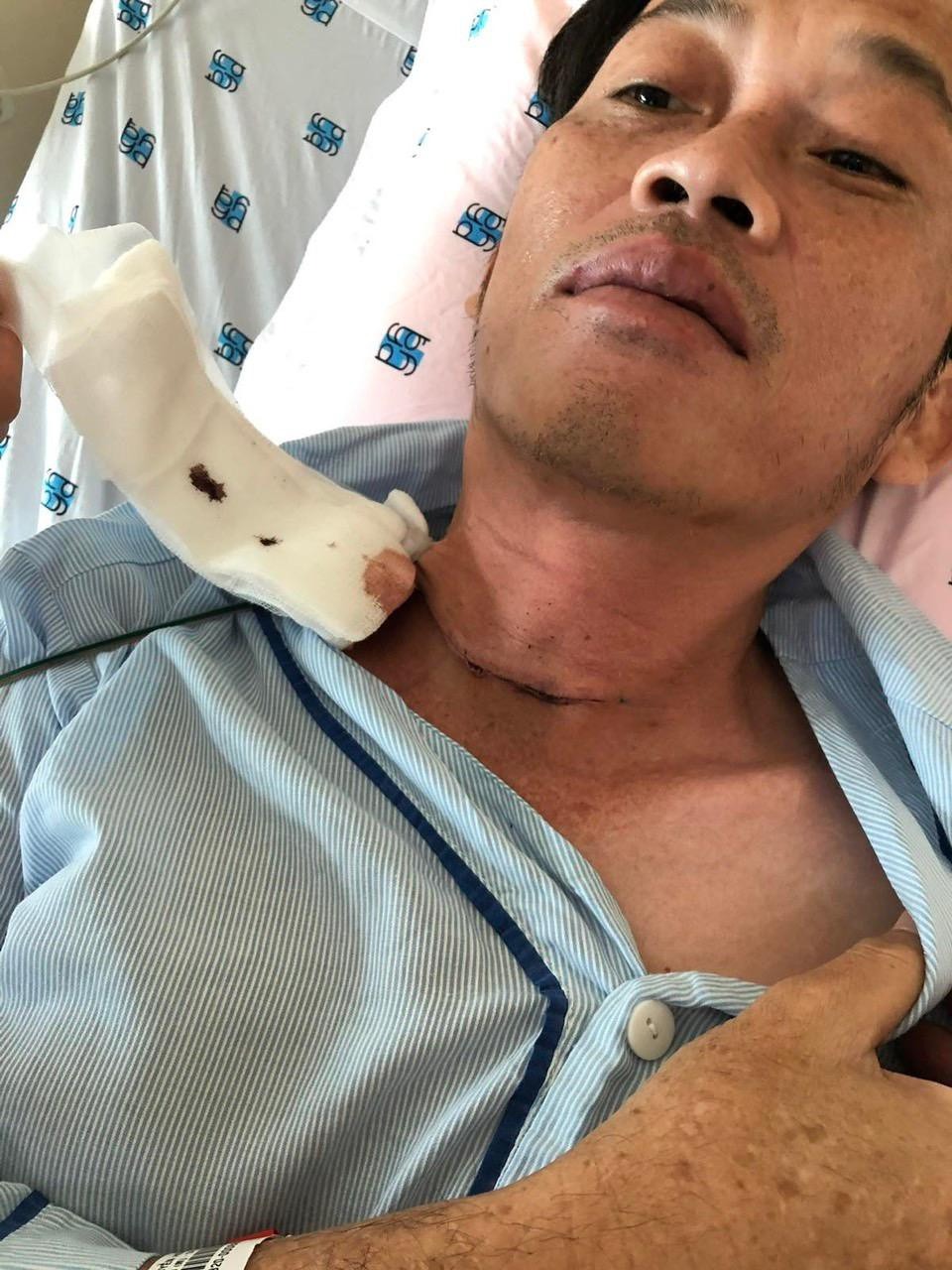 Hoài Linh sau khi thực hiện phẫu thuật. Ảnh: Tiền Phong Hoài Linh sau khi thực hiện phẫu thuật. Ảnh: Tiền Phong
