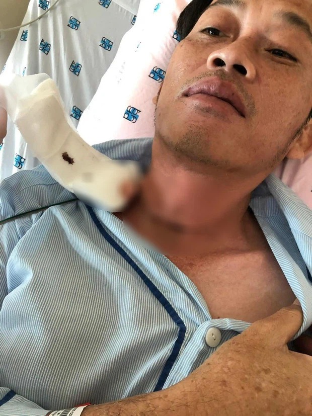 Hình ảnh Hoài Linh phẫu thuật ung thư được tung ra cùng với lời chia sẻ về ngày phẫu thuật mà báo chí đã đưa tin vào ngày 25/5. Ảnh: Internet Hình ảnh Hoài Linh phẫu thuật ung thư được tung ra cùng với lời chia sẻ về ngày phẫu thuật mà báo chí đã đưa tin vào ngày 25/5. Ảnh: Internet