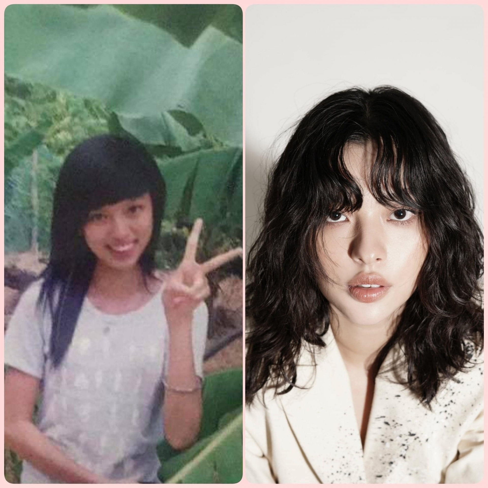 Tú Hảo khi chưa niềng răng và đã niềng răng nhiều năm