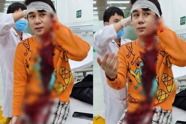 Tình trạng của nam diễn viên sau khi sự việc xảy ra. Ảnh: Internet