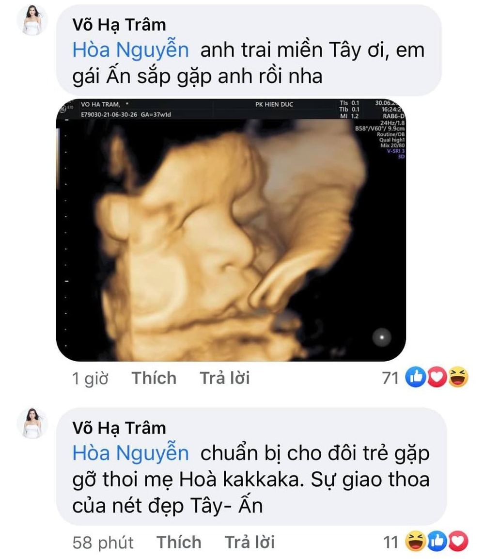 Hòa Minzy tiết lộ Võ Hạ Trâm đã sinh con bằng phương pháp ăn chay 3