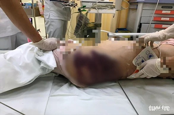NÓNG: Bắt khẩn cấp bố ruột bé gái 8 tuổi bị ‘mẹ kế’ bạo hành ở TP.HCM 2
